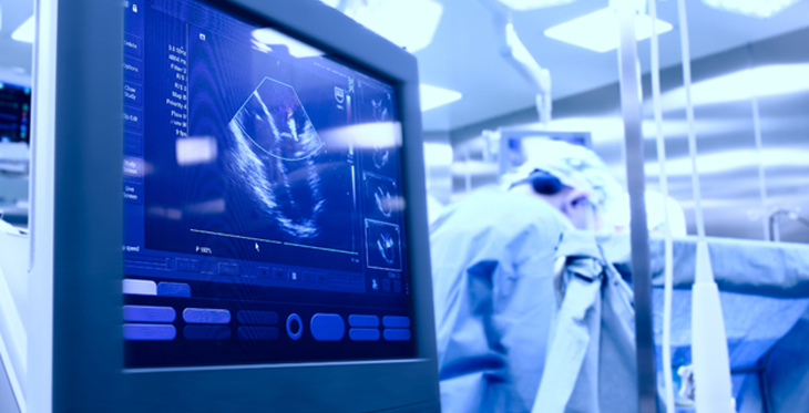tele-echocardiography in the operating room