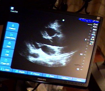 Banner Health's tele-echocardiography system
